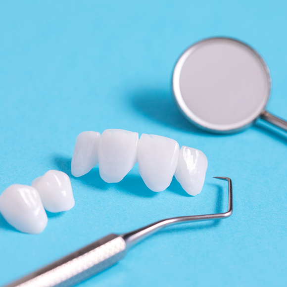 Several veneers and a dental mirror against a light blue background