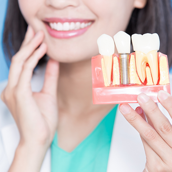 Dentist smiling and holding a model of a dental implant