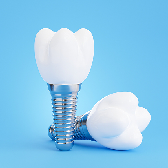 Illustration of two dental implants with crowns against light blue background