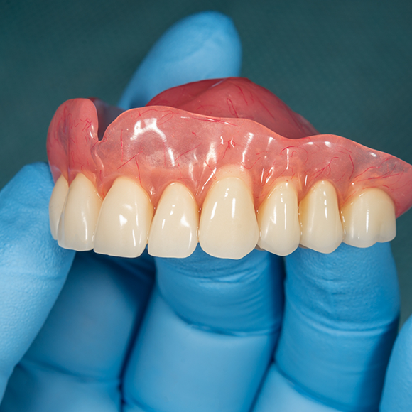 Gloved hand holding a full upper denture