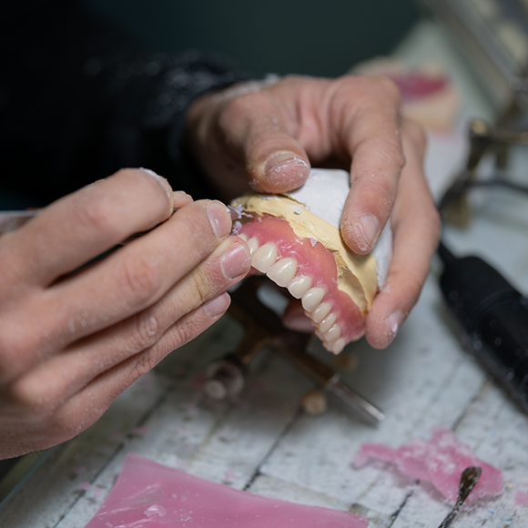 Ceramist crafting a denture