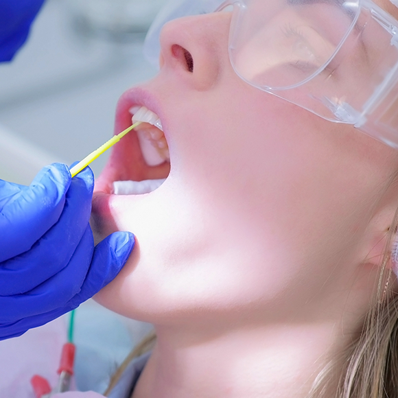 Dental patient having fluoride applied to their teeth