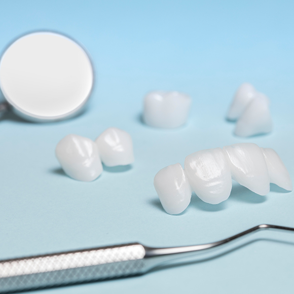 Several veneers and a dental mirror against a light blue background