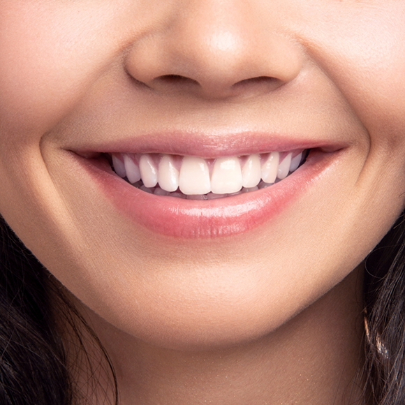 Close up of a person smiling with flawless teeth