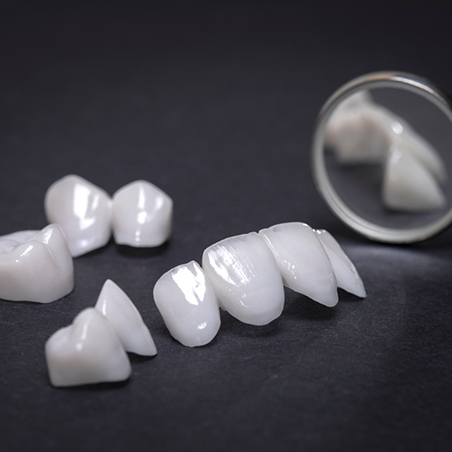 Several veneers on a gray table next to a dental mirror