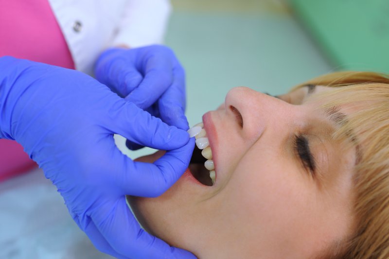 A woman getting dental veneers